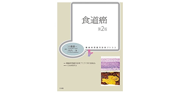 100%品質 腫瘍病理鑑別診断アトラス 食道癌 第2版 裁断済み 健康/医学